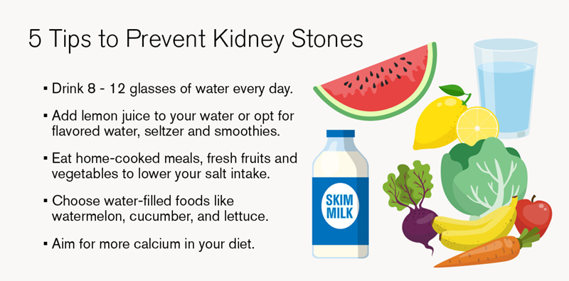 5 tips to prevent kidney stones graphic