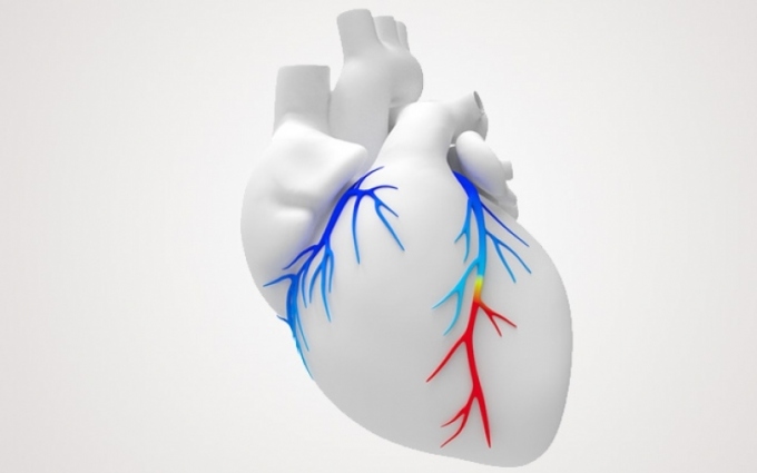 Medicare Now Covers Noninvasive Heart Test, FFR-CT, Offered at Loyola Medicine