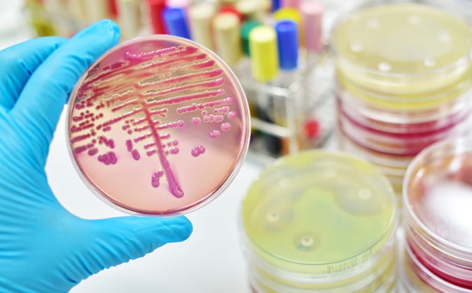 Loyola Study Finds Urine of Kidney Disease Patients Contains Diverse Mix of Bacteria