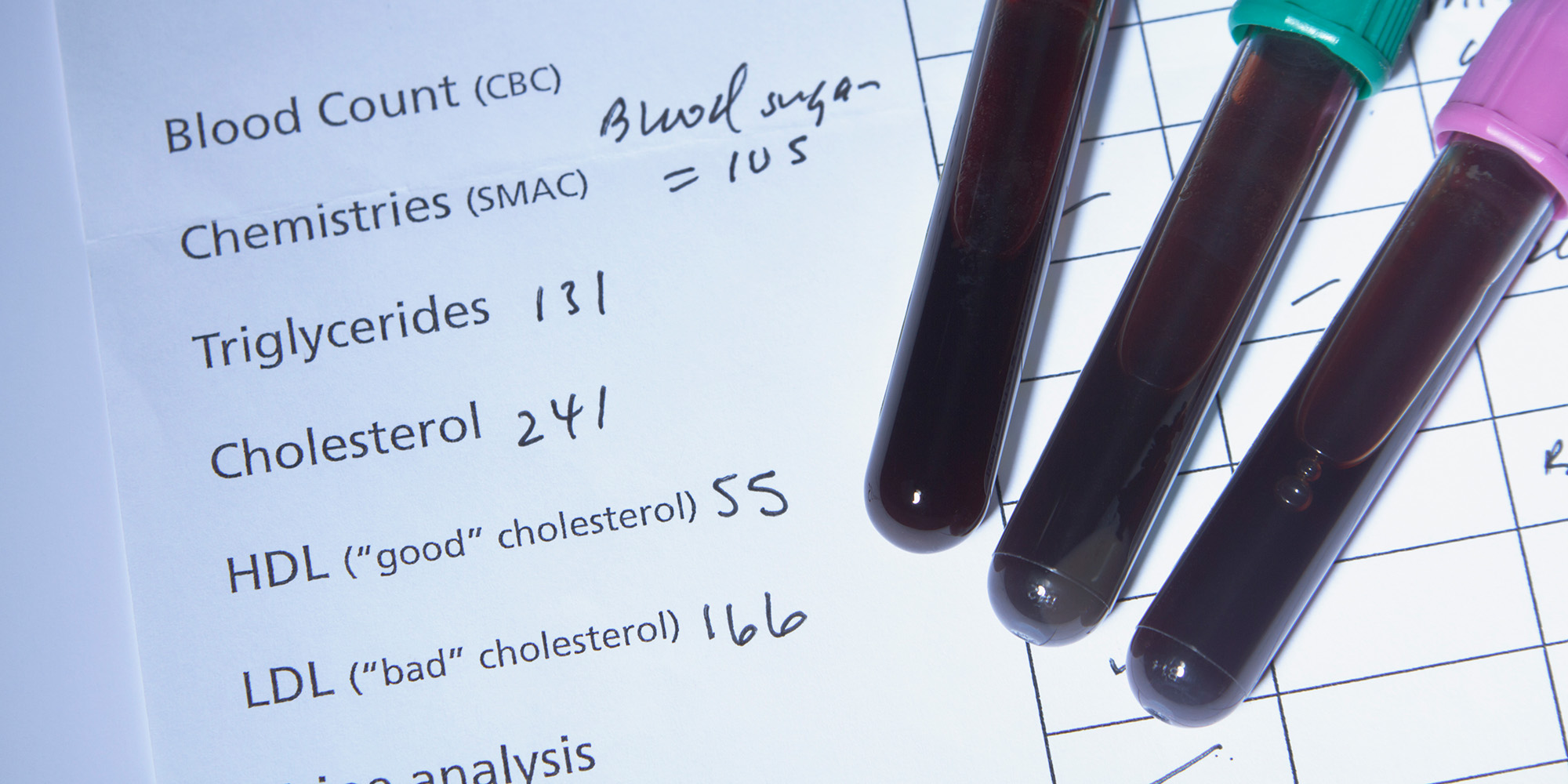 Medical vials with blood in them on paper with cholesterol levels