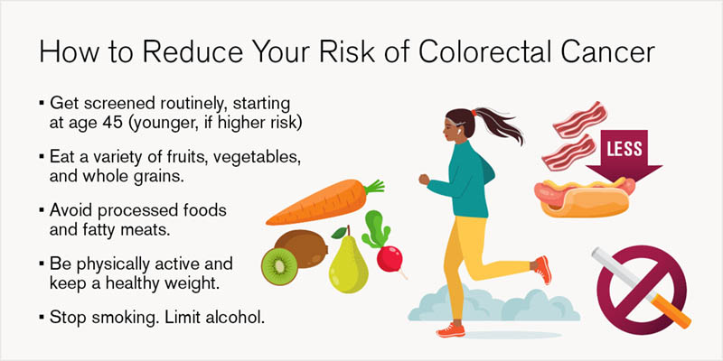 Ways to reduce risk of colon cancer graphic