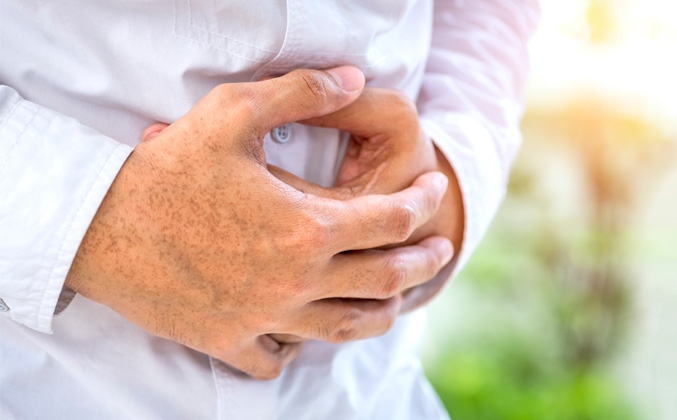 Loyola Medicine Study Explores Hypnotherapy for Gastrointestinal Issues