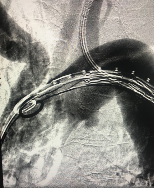 Vascular Clinical Image