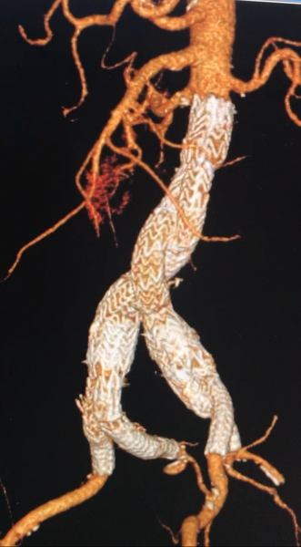 Vascular Surgery Image