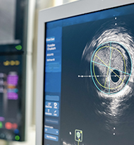 Cardiac imaging