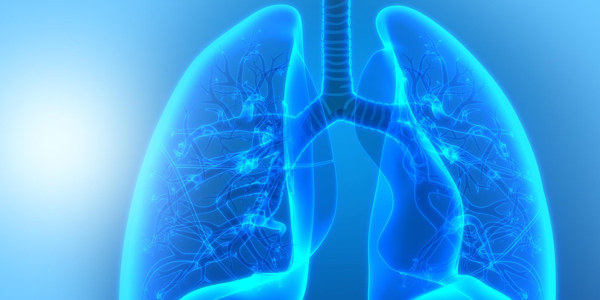 Image of lung x-ray